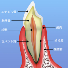 歯周病の進行